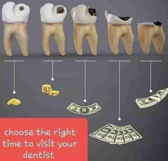 How delaying costs much more, money and pain